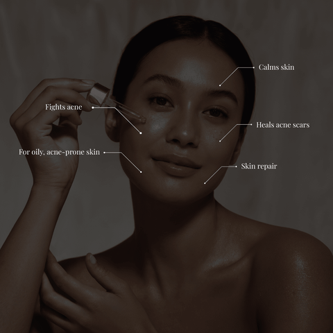 Neem & Tamanu Anti-Acne Serum - Sun Kissed Skin Care
